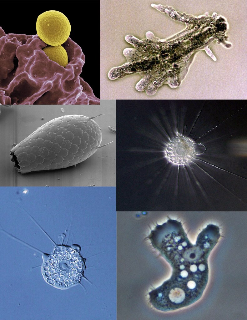 The photo shows six different types of amoebas | Small Microscopic Subatomic and Strings