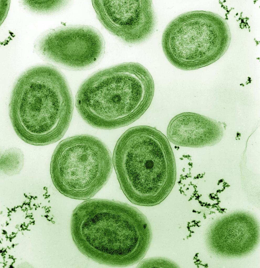 A microscopic photo of Cyanobacteria. They look like green blobs with small nucleuses. | Oxygen Blue Sky and Complex Life Exist Because of a Bacteria